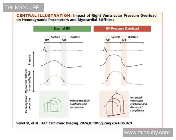 LNG战队在挑战者杯中的个人能力分析与表现评估